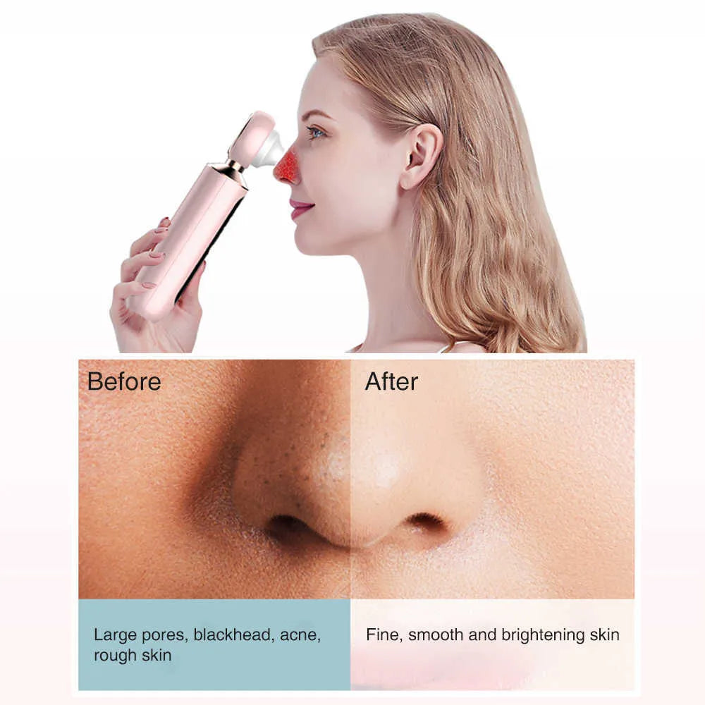 Tawfeer Mart™ Blackhead Suction Machine