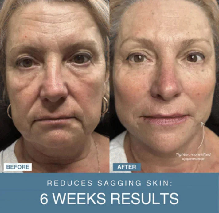 Tawfeer Mart™ 7-in-1 LED Anti-Aging/Wrinkle Apparatus