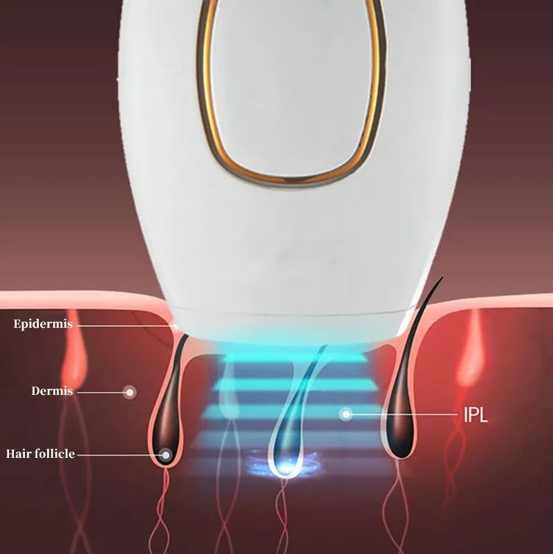 Tawfeer Mart™ IPL Laser Hair Removal – جهاز إزالة الشعر بالليزر IPL